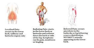 Depresses ribs ix to xii and may prevent lower ribs from being elevated when the diaphragm contracts. Low Back Pain How Can Physiotherapy Help Foundation Physiotherapy Wellness