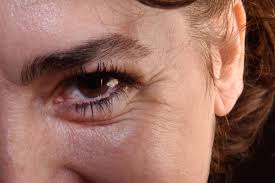 Nov 27, 2020 · to smooth out the laugh lines that appear near our eyes, all three doctors suggest going the botox route. Exercises For Laugh Lines Around The Eyes Mouth And Other Treatments