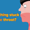Oct 16, 2019 · well, if there is something really stuck in the throat, the most effective treatment is to have it removed with the help of a professional. 1