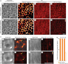 We did not find results for: In Situ Label Free Imaging Of Hemicellulose In Plant Cell Walls Using Stimulated Raman Scattering Microscopy Biotechnology For Biofuels Full Text