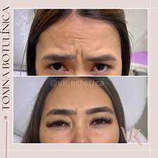 Vk ESTÉTICA (@vk.estetica_) • Instagram photos and videos