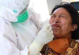 Bpkp Usul Ada Standarisasi Biaya Swab Test