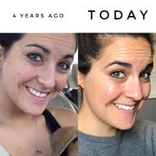 My wrinkly dogs wait for me at home