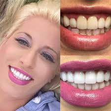 Dr. Rob Barrick The Smile Artist