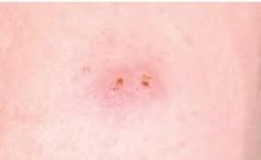 Demande bree johnson, journaliste à la bbc. Les Araignees Comment Les Repousser