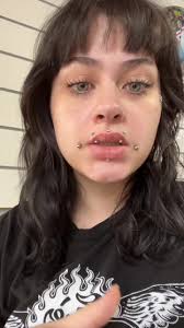 #stitch with @no Ls #greenscreen ive never had a bump get so big and just  deflate within 24 hrs but those r dahlia piercings for ya😅 #dahlia  #dahliabites #dahliapiercing #jokerbites #piercing