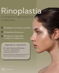 Dr.Carlo Pedroza Mendez