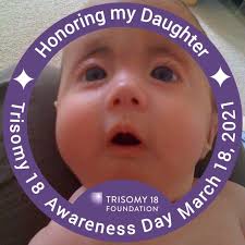 Today is Trisomy 18 Awareness Day. T18 (known as Edwards Syndrome) is  caused by 3 copies of chromosome 18 whereas Downs Syndrome is caused by 3  copies of the 21st chromosome. Most