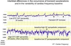 Image result for FHR Variability