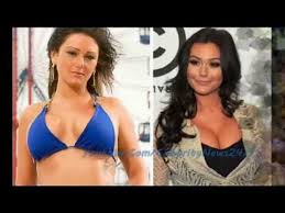 She's given her fresh, vibrant look another name: Jwoww Before And After Plastic Surgery Pictures And Video Youtube