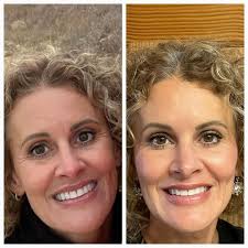 Ashton Decker, LE, CLT // David Lenser, MD (@lenseraesthetics.emporiaks) •  Instagram photos and videos