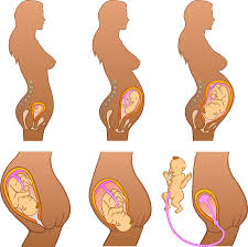 If you experience sciatica in pregnancy, your growing uterus may be the cause. Sciatica And Pregnancy The Hows And Whys By Sarah Key