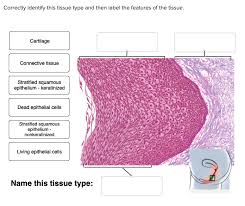 Check spelling or type a new query. Correctly Identify This Tissue Type And Then Label Chegg Com