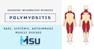 Image result for Polymyositis