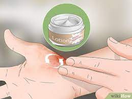 How To Heal Burns Fast (With Pictures) - Wikihow