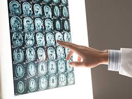 If your diagnosis is thyroid cancer, you may be able to breathe a bit easier, as it's one of the most treatable cancers when caugh. Cancer Staging National Cancer Institute
