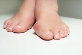 Sitting too long is a common culprit, so a simple test would be to get up and walk around every 20 minutes or so. 5 Foot Problems That Look Like A Bunion But Aren T Nagy Footcare