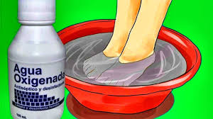 9 Usos Del Agua Oxigenada Para Tu Hogar El Canal De La Familia Lunacreciente Youtube