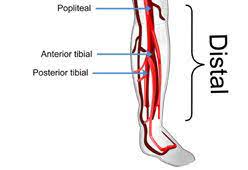 Deep Vein Thrombosis Dvt Diagnosis Signs Symptoms Thrombosis Deep Vein Thrombosis Veins