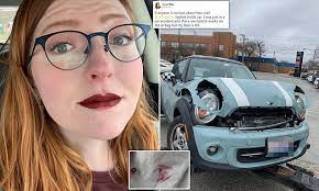 Jeffree star has been been hospitalized after a severe car accident in wyoming. Woman Shares A Flawless Jeffree Star Lipstick Selfie After Being Involved In A Car Crash Daily Mail Online
