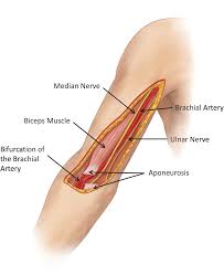 Posted on january 20, 2015 by admin. Brachial Artery Injury Chapter 37 Atlas Of Surgical Techniques In Trauma