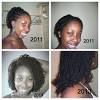 2 Year Hair Growth Before And After