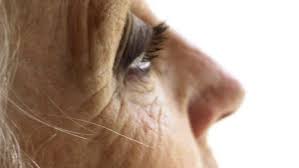 Alzheimers derimod er en bestemt sygdom, hvor lægerne ved præcis, hvilke ændringer der sker i hjernen, selvom de stadig er uenige om sygdommens årsag. Demens Ulike Former Nhi No