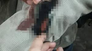 Oleh karena itu, anda perlu menjaga agar tangan sebisa mungkin tetap halus, lembut, dan sehat. Pengakuan Korban Penodongan Di Ujungberung Reflek Melawan Tangan Berdarah Kena Pisau Hp Melayang Tribun Jabar