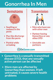 Image result for gonorrhea symptoms