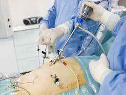 Dacă boala nu este gravă, tratamentul se începe cu medicamente antiinflamatoare, iar bolnavilor li se recomandă repaus la pat. Herniile Abdominale Simptome Diagnostic Tratament Reginamaria Ro