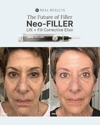 Have you ever looked in the mirror and thought, “I know I'm not tired, but  my face is saying otherwise?”😞 I hear this all the time. Women and men who  can see