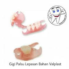 Porselen akrilik, merupakan gigi palsu yang paling banyak beredar di masyarakat karena harganya yang terjangkau. Jual Gigi Palsu Lepasan Sebagian Bahan Valplast Kota Tangerang Suriani Dental Care Tokopedia
