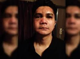 Justifying the Exuberant Interest in the Vhong Navarro Mauling Incident  (Part 1 of 2) - BlogWatch