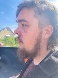 Reckless Driving in Middleton Mountain Residential Neighborhood