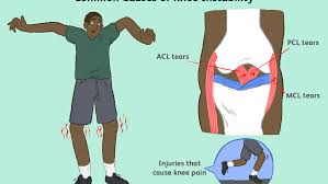 They connect bone to bone, give your joints support, and limit. Knee Joint Ligaments