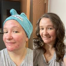 More gray hair from coaching 24 girls