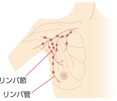 「乳がん」の画像検索結果