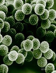 What color is ragweed pollen. Ragweed Pollen Sem Photograph By David M Phillips The Population Council