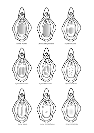 Hymen - Wikipedia