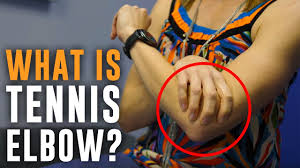 If your tennis elbow hasn't improved after a year or more of trying various treatments, your doctor may suggest you have surgery. Tennis Elbow Lateral Epicondylitis Causes Symptoms And Treatment