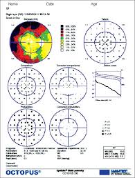 interpretation of autoperimetry nayak bk dharwadkar s j