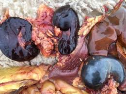 Image result for Copper Poisoning