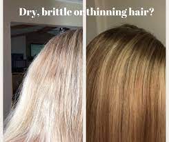 Spironolactone (aldactone) is prescribed for people who have thinning hair related to androgen production. Pin On Hair Care