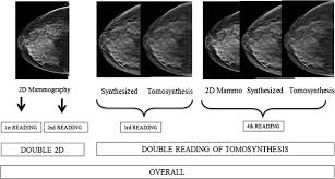 Image result for Mammogram Interpretation