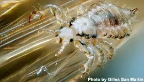 Image result for Lice