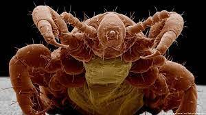 تفسير حلم القمل في الشعر وقتله في المنام موقع الرهيب