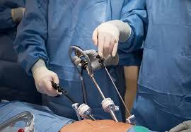 Image result for Transplantation