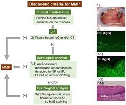 Maybe you would like to learn more about one of these? Frontiers The Diagnosis And Blistering Mechanisms Of Mucous Membrane Pemphigoid Immunology