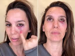 Say What Now? Beloved Texas Fisherman Killed By Flesh-Eating Bacteria