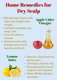 Home Remedies For Dry Scalp Dry Scalp Remedy Dry Scalp Hair Mask For Dandruff